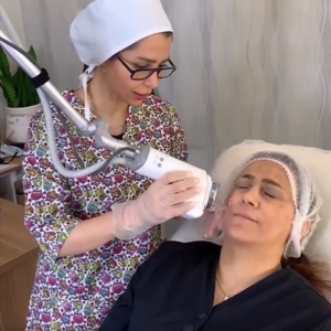 co2-laser-fractional