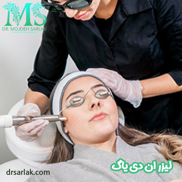 لیزر ان دی یاگ - دکتر مژده سرلک