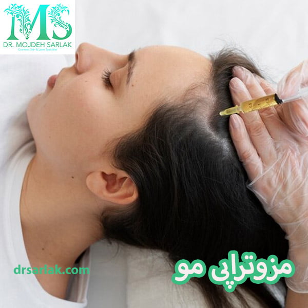 مزوتراپی مو - دکتر مژده سرلک