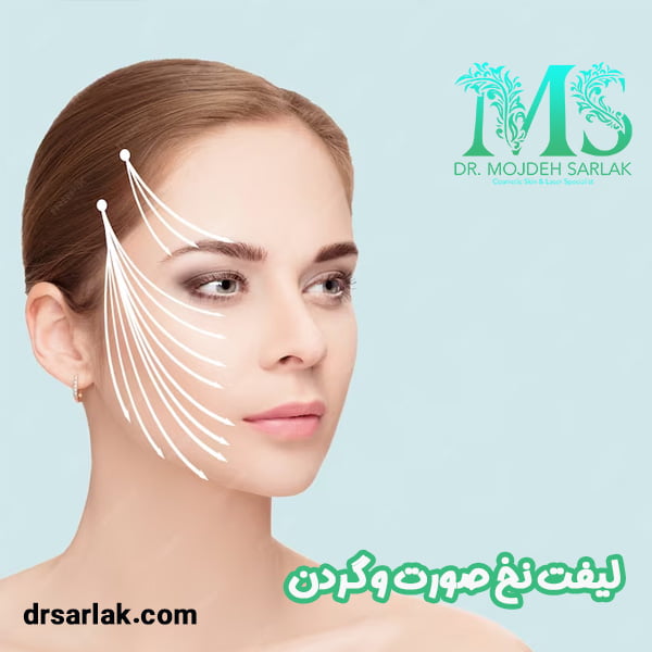 لیفت نخ صورت و گردن - دکتر مژده سرلک