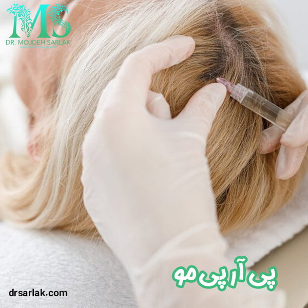پی آر پی مو - دکتر مژده سرلک