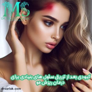 کبودی بعد از تزریق جی سل - دکتر مژده سرلک - drsarlak.com