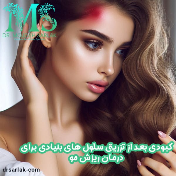 کبودی بعد از تزریق جی سل - دکتر مژده سرلک - drsarlak.com