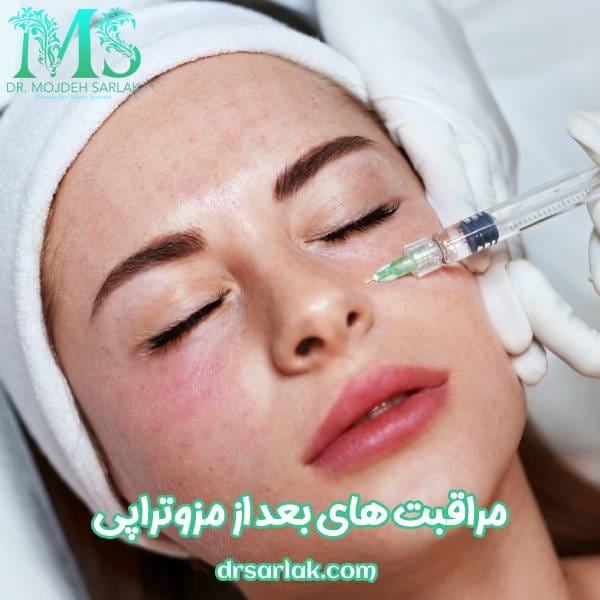 مراقبت های بعد از مزوتراپی