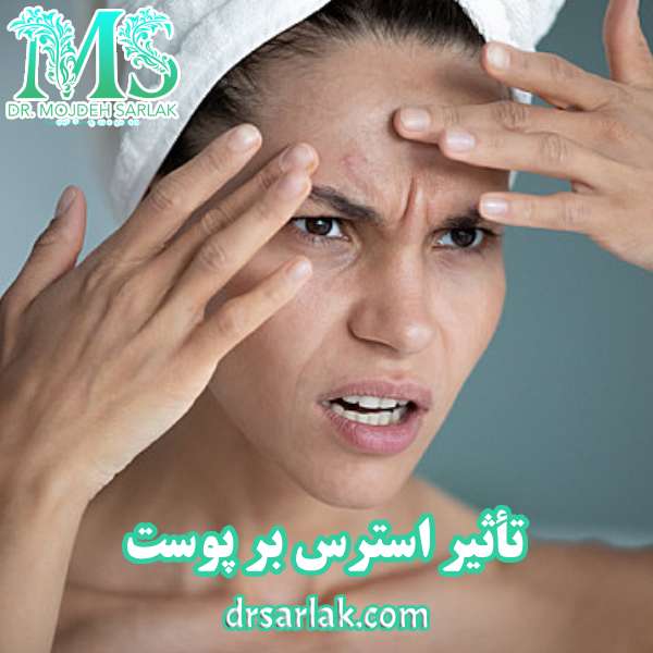 تأثیر استرس بر پوست