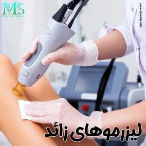 لیزرموهای زائد بدن در تهران با دکتر مژده سرلک